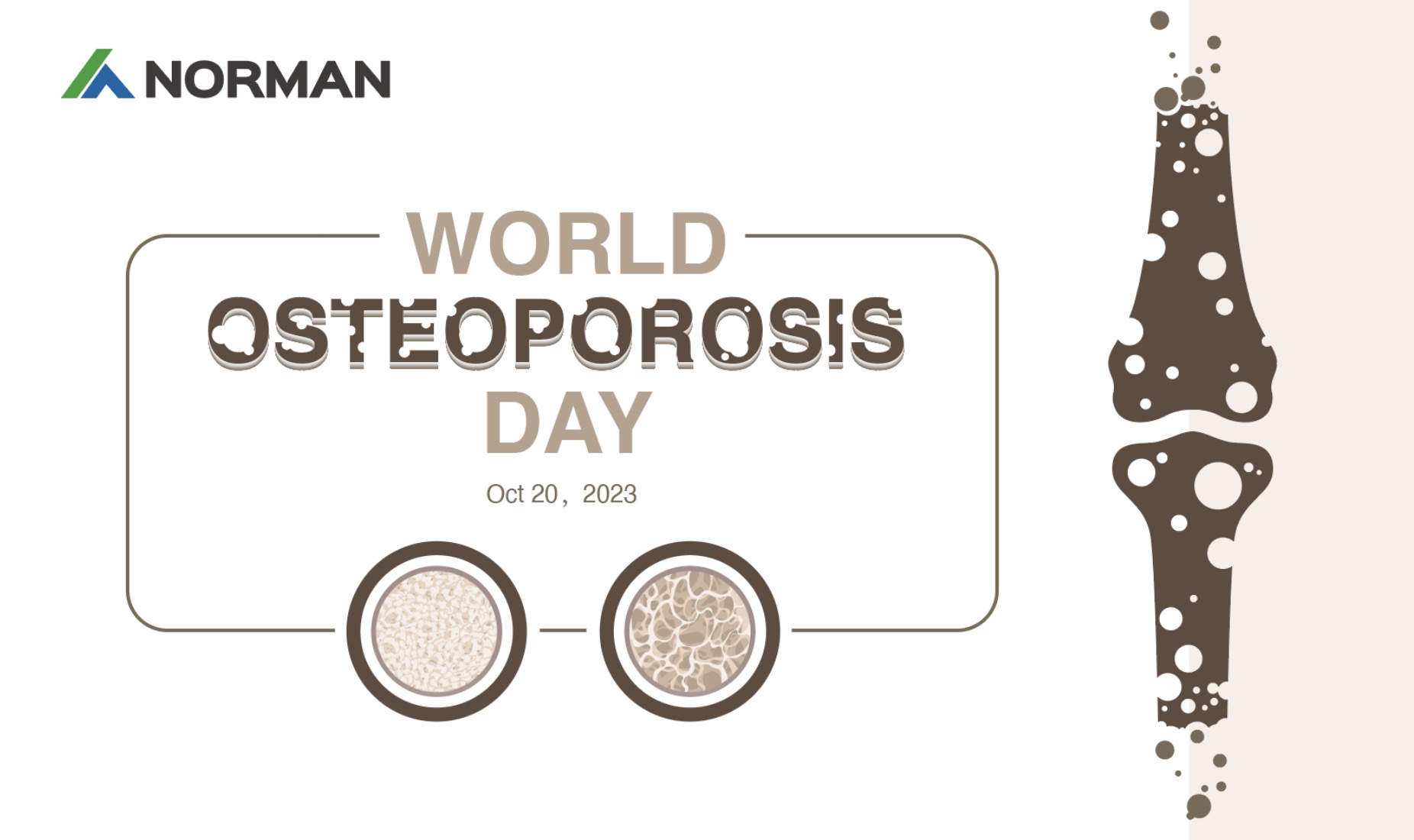 Journée mondiale de l'ostéoporose